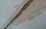 Чем заделать швы между плитами на потолке: быстрое устранение дефекта